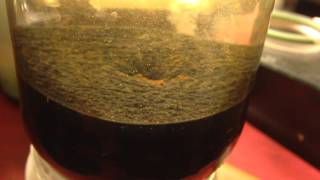 Ilginç Ganz Oluşumları