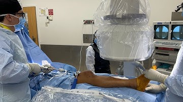 Suprapatellar tibia nailing technique