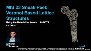 MIS 23 Sneak Peek - Voronoi Based Lattice Structures