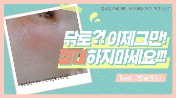 아직도 닦토하세요!? 제발 피부를 죽이지마세요..? (feat. 세븐원쓰리 몽글토너)