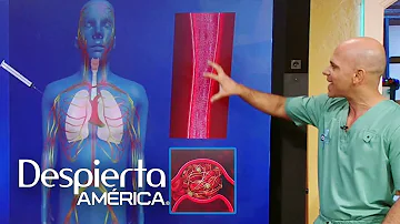 ¿Cuál es la causa principal de los coágulos sanguíneos en los pulmones?