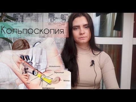 👩‍⚕️Кольпоскопия.  Как проходит исследование шейки матки?