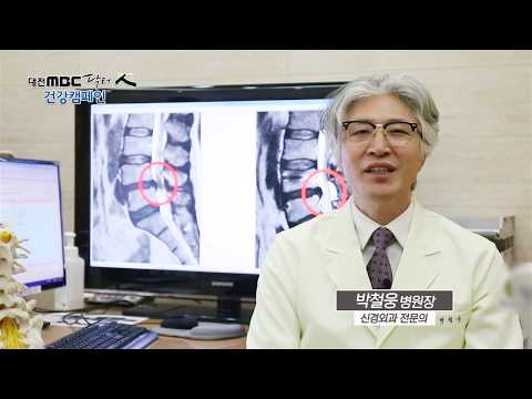 [대전MBC 의료포털 닥터인] 정형외과 - 퇴행성 척추질환