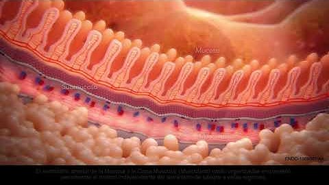 ENDO 059303 AA Resolution 360 Clip Video Promocional