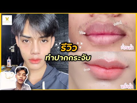 Vlog + Review: รีวิวทำปากกระจับปีกนางฟ้า ยกมุม ลิฟกราฟ  บีพราวคลีนิค จะรอดหรือจะพังกันนะ!!! |Plustar