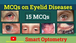 MCQs- Eyelid Diseases (DHA/HAAD/MOH)