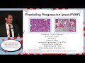 Prognostication and initiation of therapy in Polycythemia vera: Do we have it right?