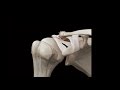 Breaking Down The Differences In AC Joint Sprains