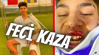 FUTBOL HAYATIM BİTTİ Mİ? (FECİ MOTOR KAZASI GEÇİRDİM)