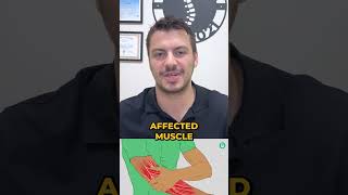 Uncover the Hidden Pain: What Are Trigger Points?