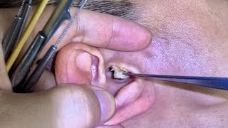 耳掃除 귀 청소 Ear Cleaning #339