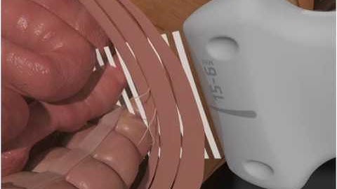 How To: TRANSVERSE ABDOMINIS PLANE (TAP) BLOCK 3D Video