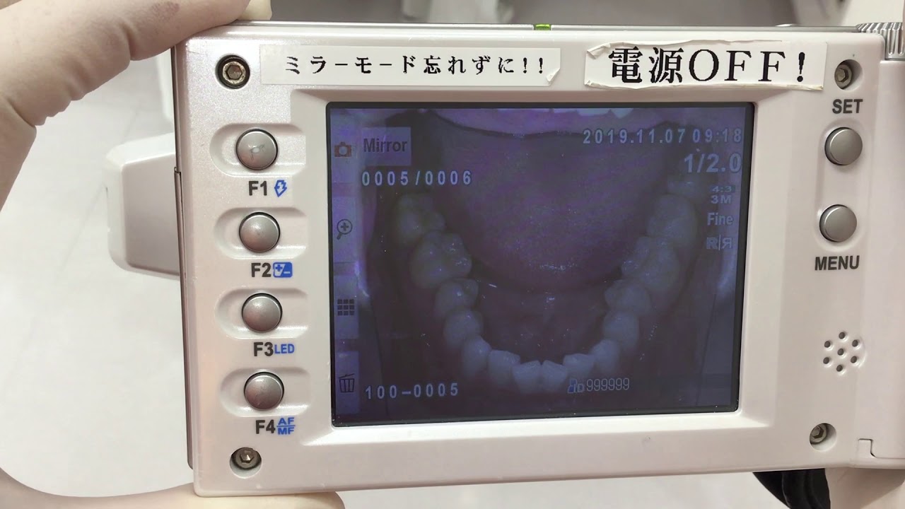 新品！松風アイスペシャルC-V デジタル口腔撮影装置（アイスペシャル C 