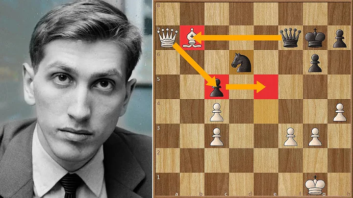 The Bobby Fischer Story | Fischer vs Huebner | Pal...