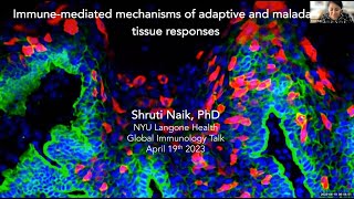 "Immune mediated mechanism of adaptive and maladaptive tissue responses" by Dr. Shruti Naik screenshot 2
