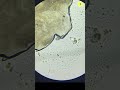 Acne under the microscope shorts microscope underamicroscope demodex