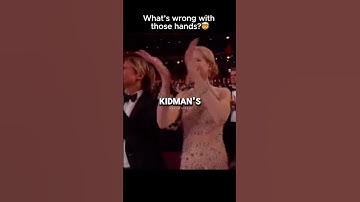 Watch Her Hands Closely 👀