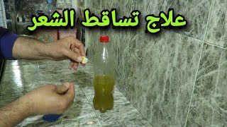 طريقة علاج تساقط الشعر بمكونين فقط (ثوم و زيت الزيتون )