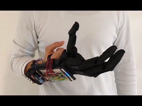 Youbionic Hand Commercial