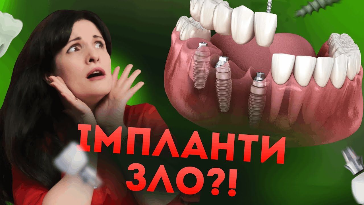 Кому НЕ можна ставити імпланти?