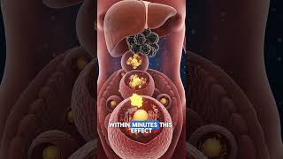 The Silent Killer: Cholesterol Disease Explained(Don’t Ignore These Signs!)#Cholesterol #HeartHealth