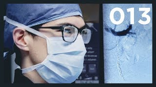 Treating Infertility with Metallic Coils - Varicocele Embolization Procedure / Vlog013 by Dr. Jon & Dr. Chris 78,375 views 5 years ago 8 minutes, 37 seconds