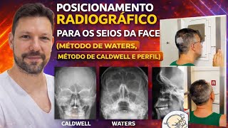 Raio-X Rotina Para Seios Da Face Waters, Caldwell E Perfil