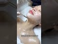 Trị liệu Enzyme Cryo Pro X