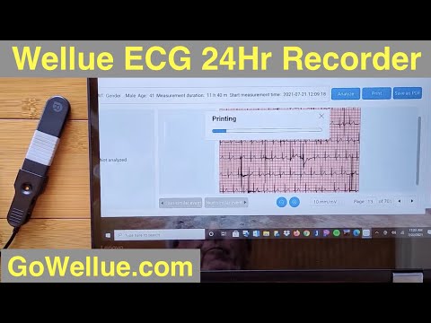 Wellue Heart Health Monitor with 24 hour Continuous ECG Recorder and AI Analysis: Unboxing & Review
