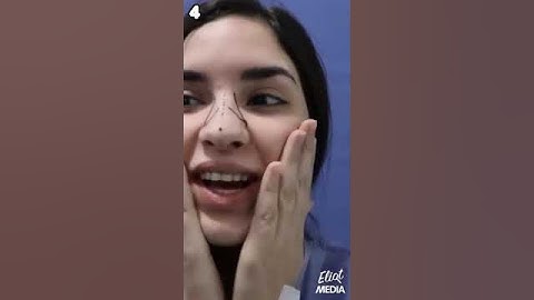ESTAS SON TODAS LAS CIRUGÍAS QUE SE HA HECHO KIMBERLY LOAIZA #Shorts