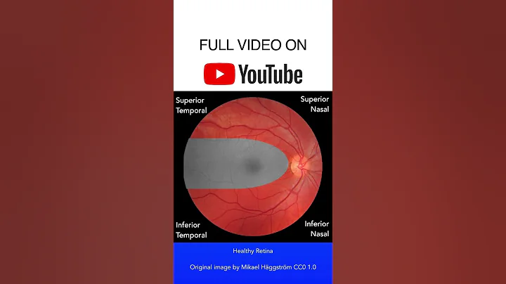 Healthy Retina Fundoscopy