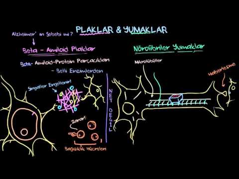 Alzheimer Hastalığı: Plaklar Ve Yumaklar