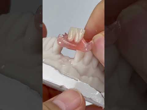 Immediate Tooth Option