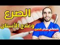 علاج الاسنان عند مريض الصرع ما تحتاج معرفته لزيارة آمنة