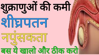 गुप्त रोगों से परेशान हो चिंता मत करो बस अपनी डाइट में ये चीज़ इस्तेमाल कर लोऔर अपना कीमती पैसा बचाओ। screenshot 4