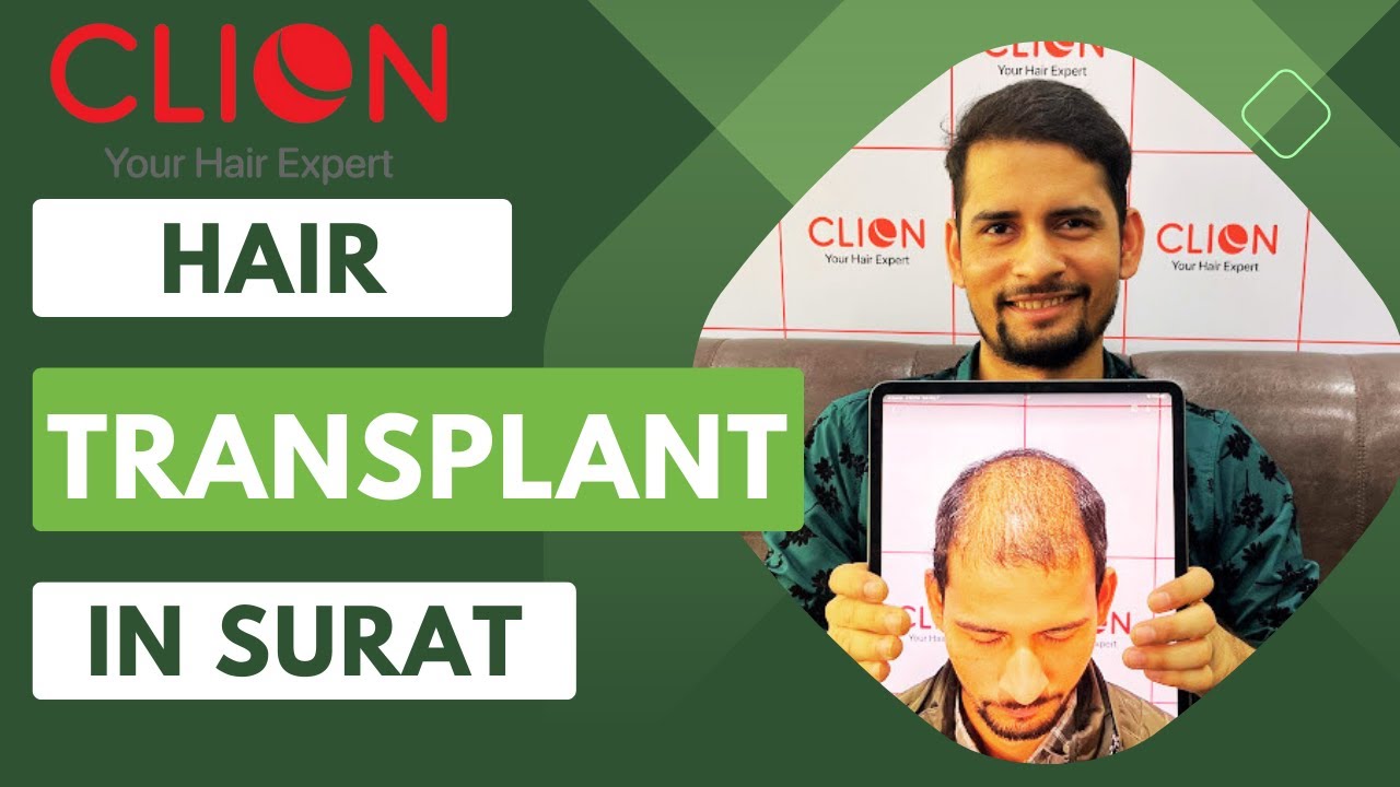 Best Hair Transplant Clinic in Surat | Hair N Images Clinic