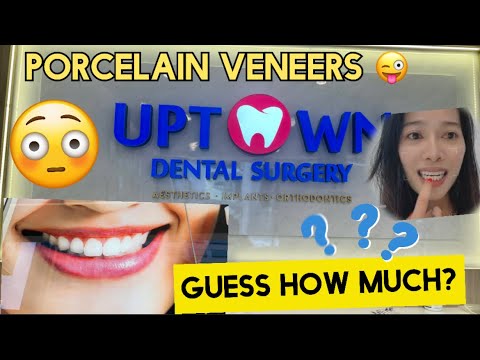 Porcelain veneers magkano doc? Every 6mons dental cleaning 🦷 |rena evlog(madaliang video Lang to)