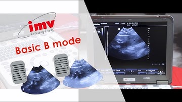 How to use the Mindray M6 video 2 - Basic B mode settings