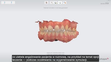 3Shape TRIOS Treatment Simulator Workflow PL