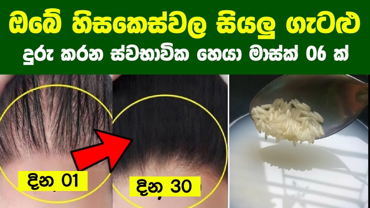 ඔබේ හිසකෙස්වල සියලු ගැටළු දුරු කරන ස්වභාවික හෙයා මාස්ක් 6 ක් | 6 Hair Masks To Treat Hair Loss