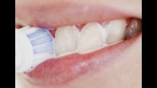 Secrets to Brighter, Whiter Teeth | 5 Solution Better Life
