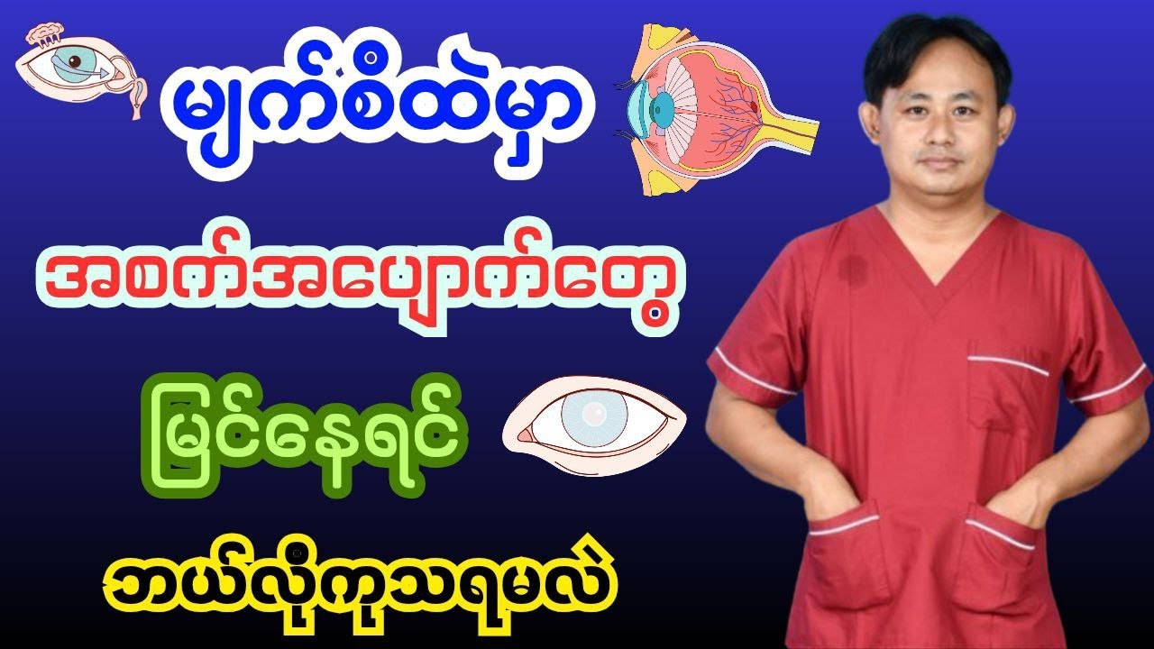 မြင်ကွင်းထဲမှာ ပေါ်နေတဲ့ အစက်အပျောက်များ ( Eye Floaters )