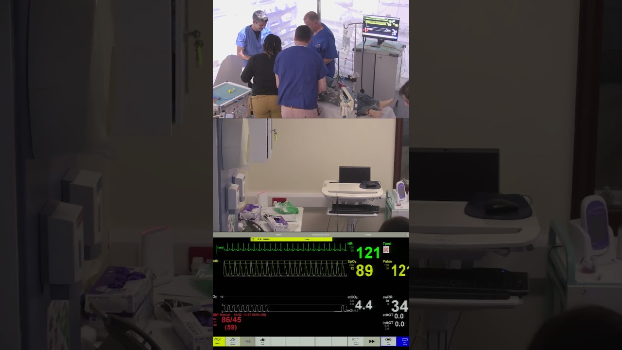 Anaesthetics Simulation &ndash; Burns Airway Emergency with Front of Neck Access (FONA)