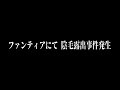 【ガチ】〇ン毛露出【これホント】