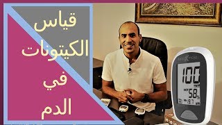 قياس الكيتون في الدم باستخدام كيتو موجو (2019) (keto Mojo)