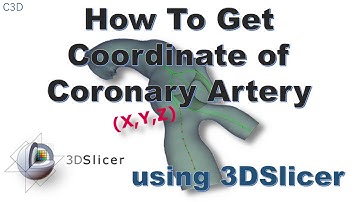 How to get coordinate (x,y,z) of coronary artery using 3DSlicer - All tools are free, open-source