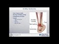 Dr. Elena Wellens - "A Minimally Invasive Treatment Option for Heel Pain"