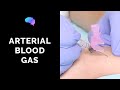 How to take an arterial blood gas (ABG) - OSCE guide
