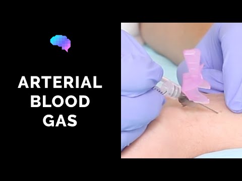 Video: Siapa yang menarik gas darah arteri?