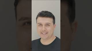 Saç Dökülme Sorununu Protez Saç ile Çöz! - Hair Replacement Resimi